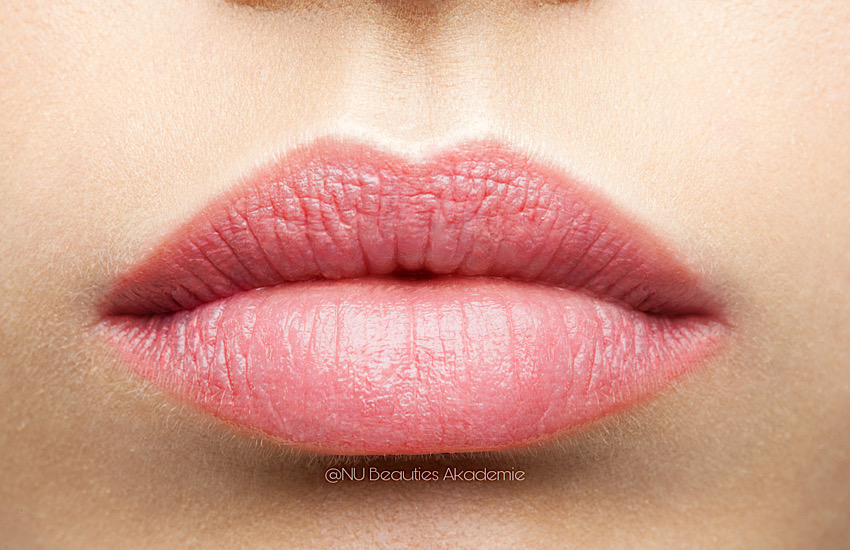 Lippenvolumenaufbau mit Microneedling